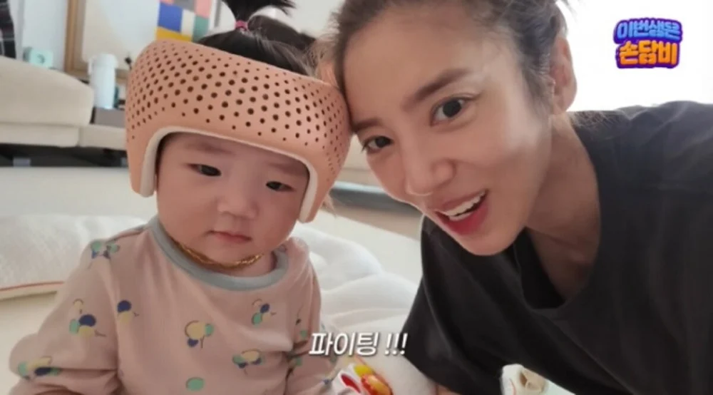 Son Dam Bi Shares Transformation of 8-Month-Old Daughter After 5 Weeks of Head Shape Correction - SukaKpop.com - Kpop and Korean Drama Top News